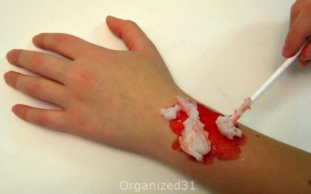 hand with white stick spreading gel on child's forearm