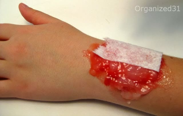 child's arm with special effects red gooey gel and paper towel on top